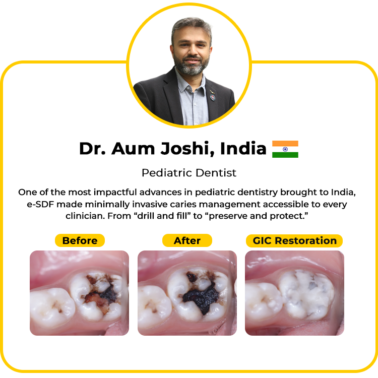 before_after